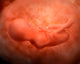Medical Illustration Fetus Development Wall Decal Design 3