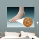 Anatomy Foot Fungus with Wall Decal