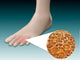 Anatomy Foot Fungus with Wall Decal