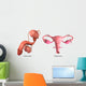Biomedical Illustration Vasectomy and Wall Decal