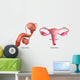 Biomedical Illustration Vasectomy and Wall Decal