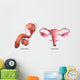 Biomedical Illustration Vasectomy and Wall Decal