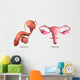 Biomedical Illustration Vasectomy and Wall Decal