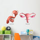 Biomedical Illustration Vasectomy and Wall Decal