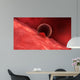 Blastocyst Begins Implanting Wall - Wall Decal