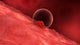 Blastocyst Begins Implanting Wall - Wall Decal