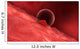 Blastocyst Begins Implanting Wall - Wall Decal