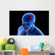 Conceptual Image Tumor Human Wall Decal