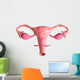 Biomedical Illustration Tubectomy Wall Decal Design 1