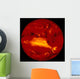 Sun Wall Decal
