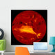Sun Wall Decal
